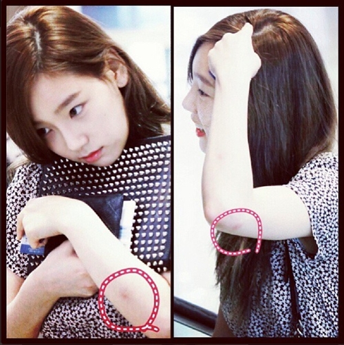 ▲태연모기(사진=태연인스타그램)