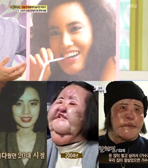 ▲선풍기아줌마(사진=KBS2TV'여유만만',채널A'그때그사람들'캡처)