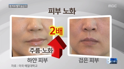 ▲하얀얼굴빨리노화(사진=MBC캡처)