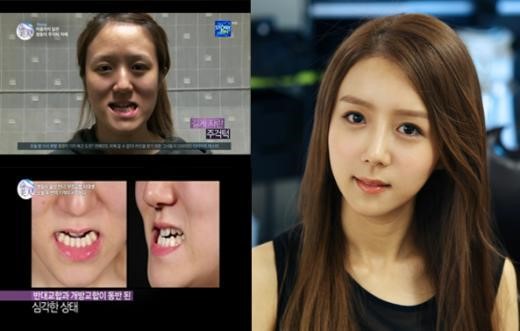 ▲렛미인방미정