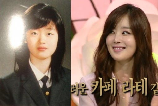 ▲안녕하세요한선화성형의혹