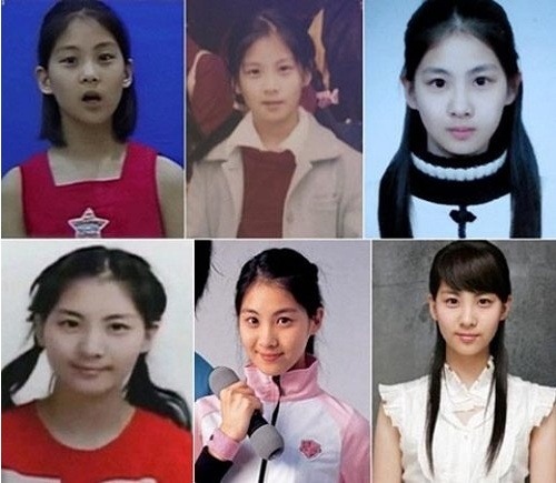 ▲서현어린시절(사진=인터넷게시판)