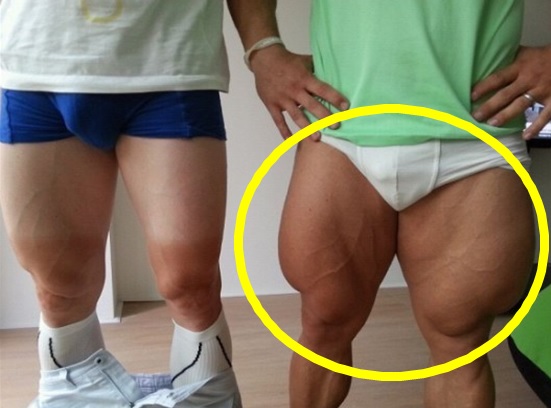 ▲헐크다리가진남자(사진=인터넷게시판)