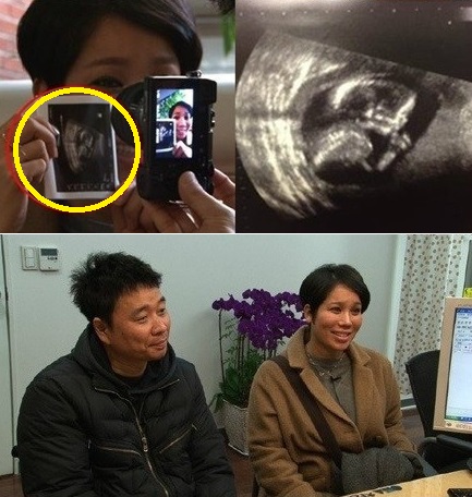 ▲김송눈물(사진=KBS방송캡처)