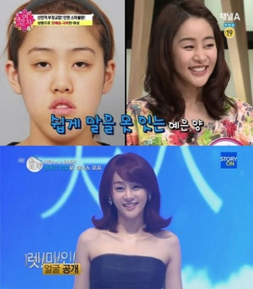 ▲렛미인허예은