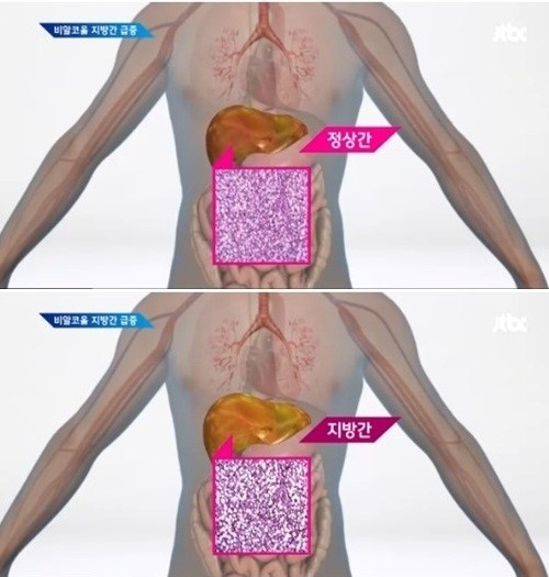 ▲지방간예방법(사진=JTBC방송캡처)