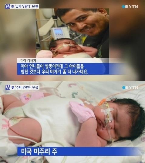 ▲6.4kg슈퍼우량아(사진=YTN방송캡처)