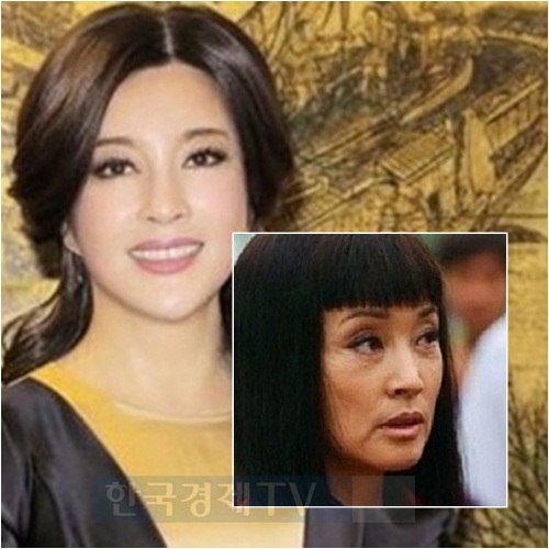 ▲류샤오칭성형전(사진=온라인커뮤니티)