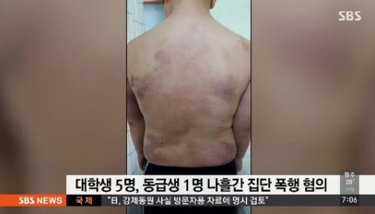 동급생 폭행 대학생…닷새동안 폭행