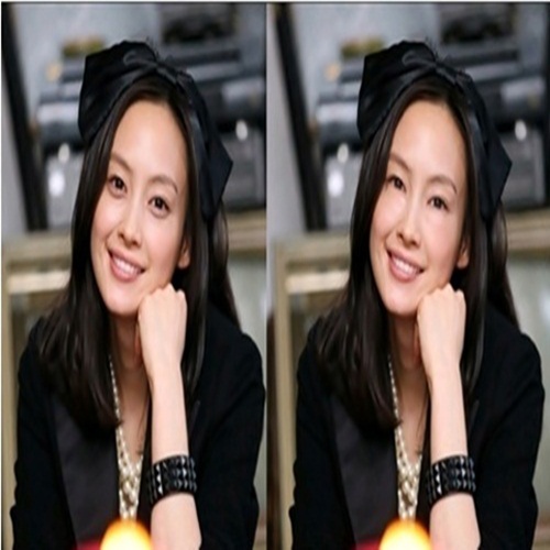 이나영, 눈 밑 애교살 제거한 사진 보니