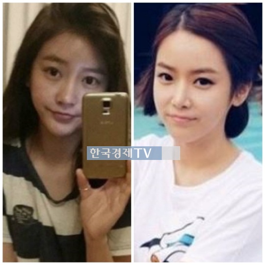 컴백 티아라 소연, 과거 성형 의혹 해명...왜?