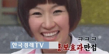 라디오스타 자두 “성형했는데…또 해야하나 고민중?’