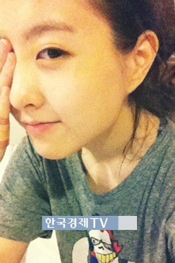 돌연변이 박보영, ‘한쪽 눈 가린채..굴욕 없는 미모’