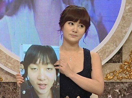 박나래, 솔직 고백 "성형 전 모태솔로였다"