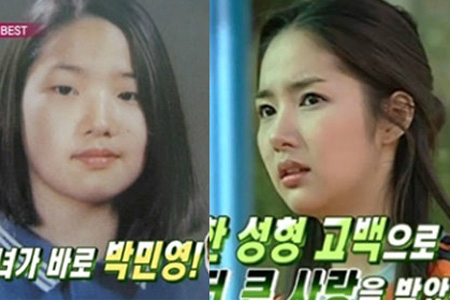 박민영, 성형 전 모습 어떻길래...'같은 사람 맞아?'
