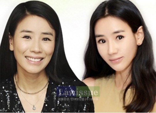 비디오스타 윤현숙, 양악 수술 후 미모 돋보여..."오랜 턱관절 고통에서 벗어나서 만족해"