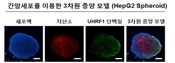 ▲간암세포로부터 형성된 종양의 내부에는 저산소 상태가 형성되며 UHRF1 단백질의 급격한 감소가 관찰됨