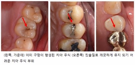 (사진=강동경희대병원)