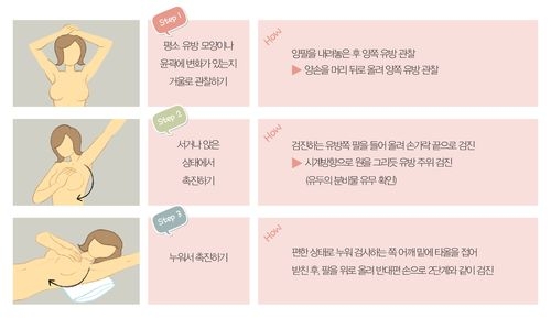 유방암 자가진단법(사진=경희대병원)