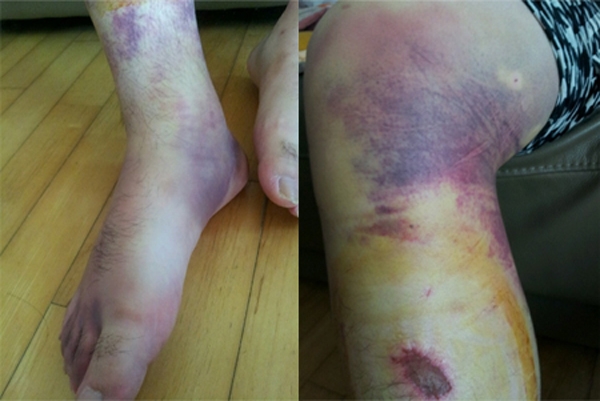 부산대병원 교수, 손찌검이 다반사...갖가지 의혹 무성한 말들