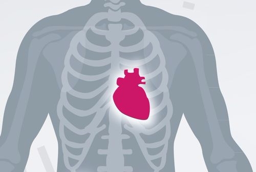 심방세동 환자, 일반인보다 허혈성 뇌졸중 위험성 5배 높다