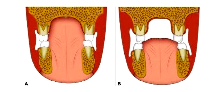 건국대병원, 오는 20일 ‘돌출입의 진단과 치료’ 건강강좌 개최