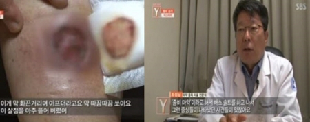 방송보도화면캡쳐
