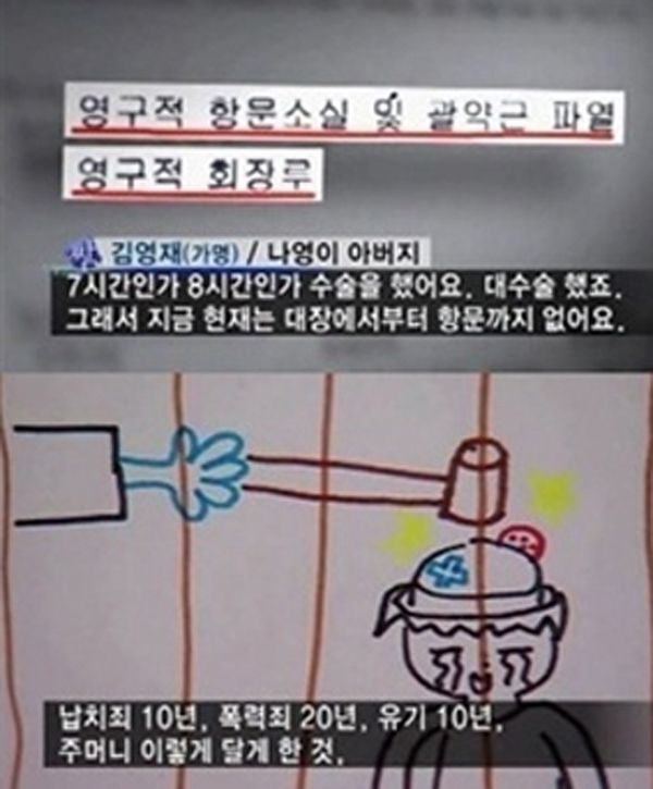 조두순 얼굴, 상상초월 몹쓸짓 막는 유일한 방법일까? 과거 행적 다시 생각해도 '끔찍'