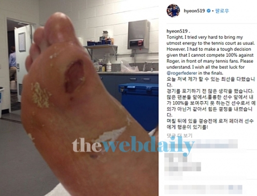 정현 발, 보는 이들 조차 먹먹하게 만들 정도...혼이 담긴 그의 발