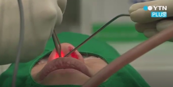 '비중격만곡증', 콧구멍 사이 막이 휘어지며 발생....가수로서는 치명적일 수 밖에