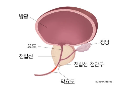 전립선과 요도 (사진=분당서울대병원)