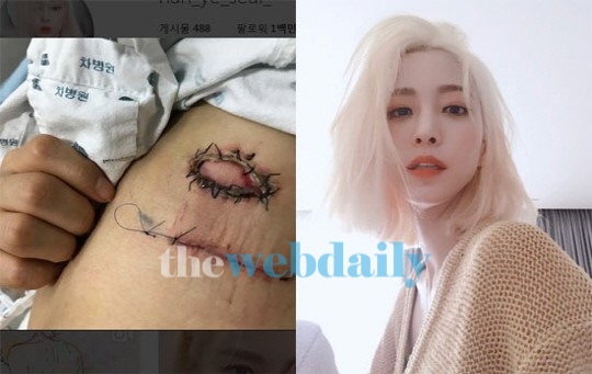 '지방종' 한예슬 그리고 차병원, 이른 아침까지 뜨거운 감자....이런 일이 어쩌다가