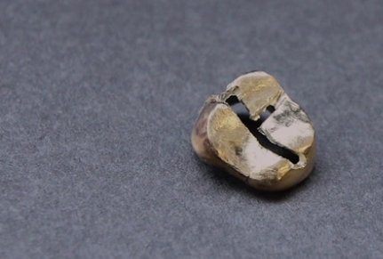 (사진=유디치과)