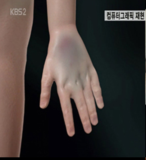 다시 회자되는 학대사건...뒤늦게 불안감 가중 '편치 않은 마음'