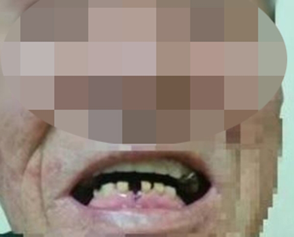 70대 경비원 때린 10대, 상상 초월하는 만행에 공분