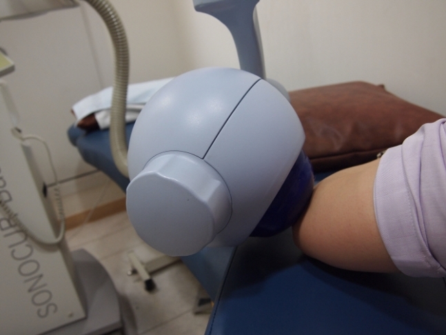 강남 연세사랑병원 비수술센터에서 어깨 및 상지관절 환자에게 체외충격파 시술을 하고 있다.