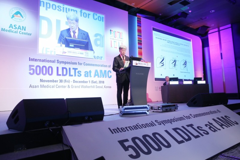 ‘2018 생체 간이식 5천례 기념 국제심포지엄’ 에서 서울아산병원 간이식·간담도 외과 이승규 석좌교수가 발표를 하고 있다. (사진=서울아산병원)