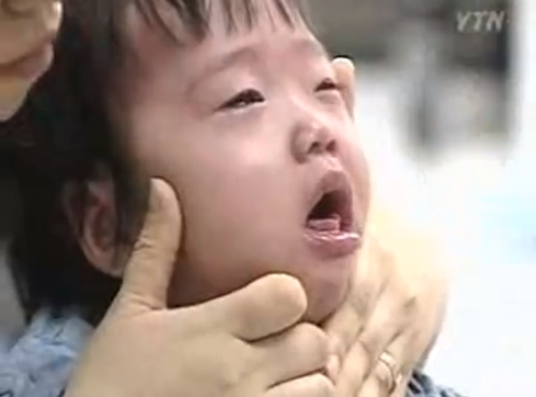 사진= RSV 바이러스 /YTN 뉴스화면