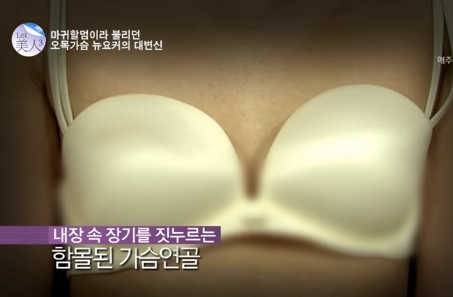 렛미인 방송 오목가슴