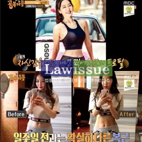 출처 : 방송화면캡쳐 / 치과의사 이수진