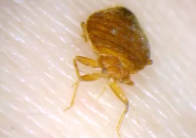 사진만 봐도 가려워...세간 흥분시킨 베드버그 대처법