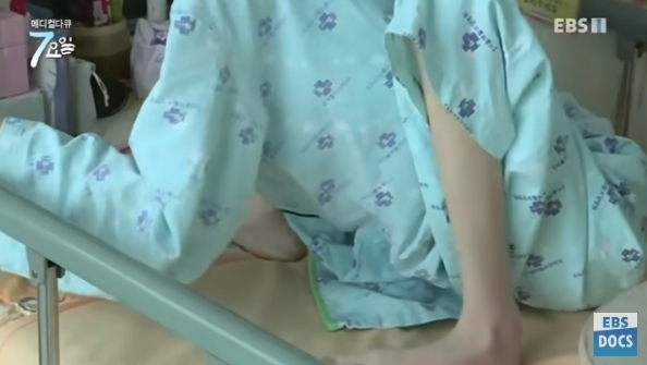사진= 근이영양증 환자의 마른 다리 모습. EBS방송화면