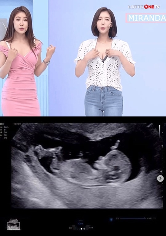 김영은 임신 소식이 전해졌다.