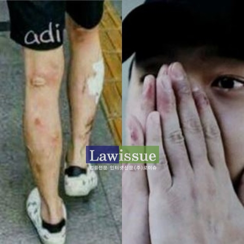 박유천 다리, 하루가 지나도 쏠리는 이목...어쩌다