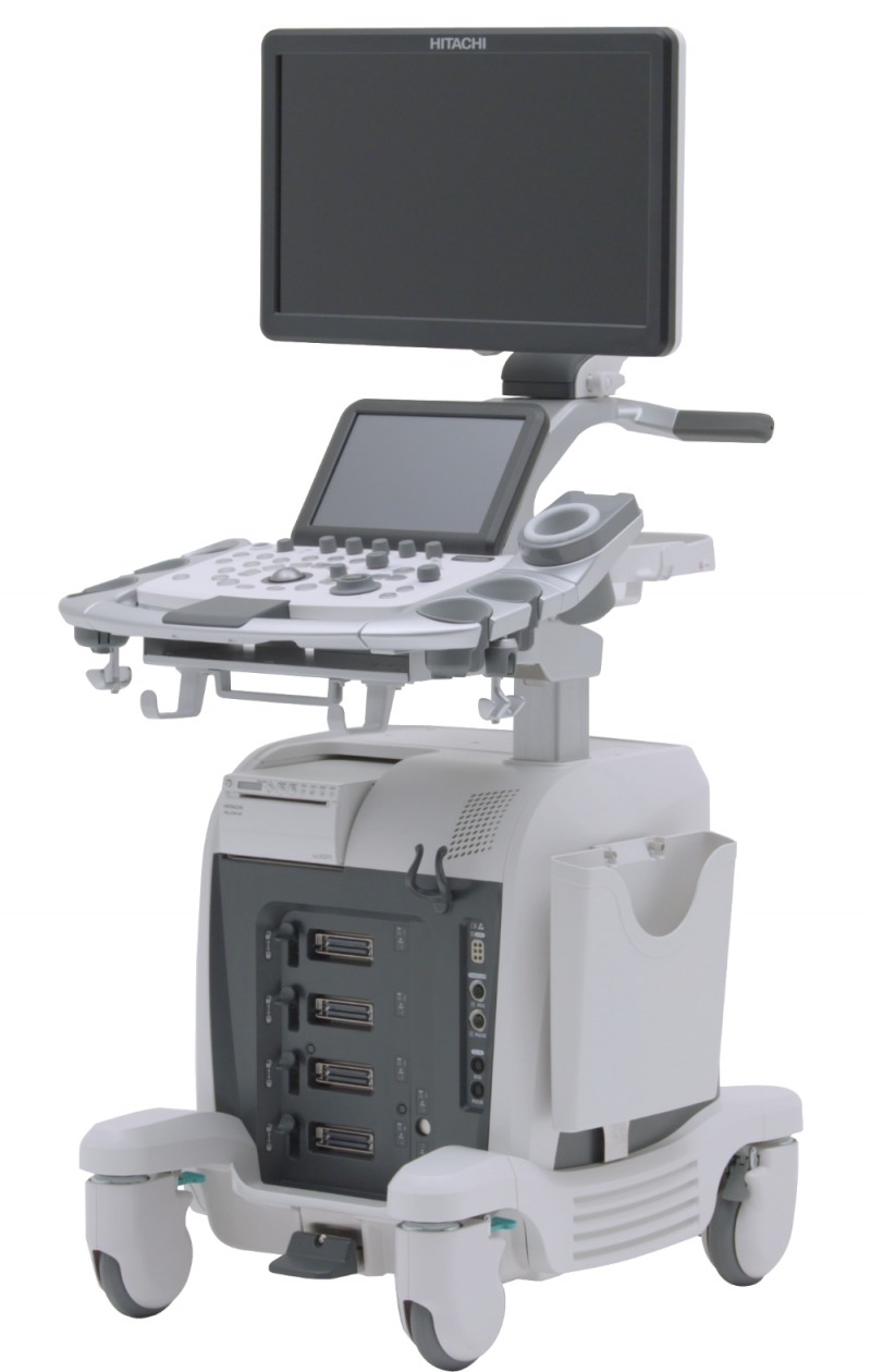 ARIETTA65 (사진=JW메디칼)