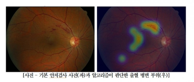(사진=분당서울대병원)