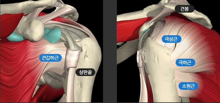 운동 열심히 했는데도 아픈 어깨, 오십견일까?