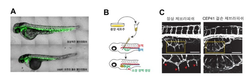 섬모조절유전자 CEP41이 결손된 제브라피쉬에서 나타난 혈관 형성 이상. 사진=한국연구재단