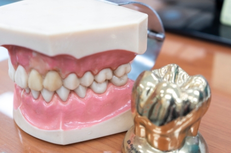 이가 시리고 아프다면 치아우식증 의심