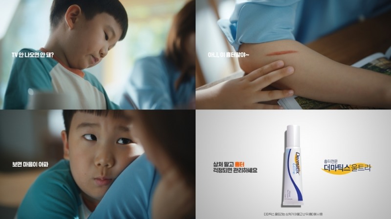 한국메나리니 흉터치료제 ‘더마틱스울트라’, 장윤정X연우 모델 TV 광고 온에어